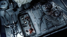 - Lycans are allergic to silver. If we don't get our bullets out quickly, they die during questioning.
- What do you do with them after?
- We put the bullets back in.