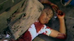 Similar atrocities occurred in neighboring El Salvador, where US trained troops stabbed de-capitated, raped and machine gunned 767 civilians in the village of El Mozote in late 1981, including 358 children under age 13. Congress ended up funneling almost $6 billion to this tiny country making it the largest recipient of US foreign aid per capita in the world. Wealthy landlords were running the right-wing death squads that murdered thousands of suspected leftists. The death toll from the war reached 70,000.